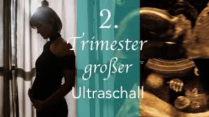 Schwangerschaftswoche wächst vor allem das gehirn. 21 Ssw Schwangerschaftswoche