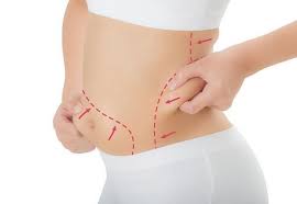 تجربتي مع تكسير الدهون تفتيت الدهون بأحدث التقنيات الحديثة In 2020 Cool Body Sculpting Laser Liposuction Liposuction
