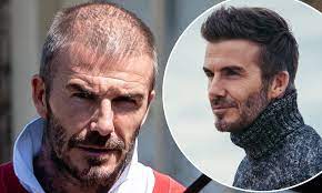 The uk hair loss experts at hishair offer advice, diagnosis and treatment for men and women suffering from hair loss. David Beckham Sports Drastically Thinning Locks During Shopping Trip In The Cotswolds Daily Mail Online