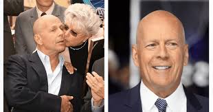 Bruce Willis's mom Marlene 'not sure if her son still recognizes her' as  'aggressiveness' creeps in