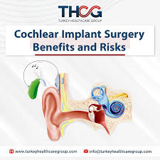 Image result for Cochlear Implant