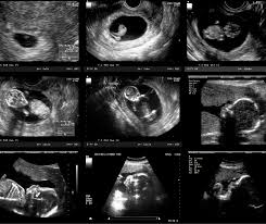 Image result for Ultrasound