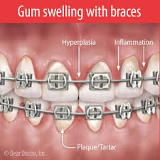 We did not find results for: My Blog General And Cosmetic Dentist