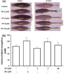 Submitted 7 months ago by sheritatravels. The Evects Of Apigenin On Hair Growth In Rat Vibrissa Follicles A Download Scientific Diagram