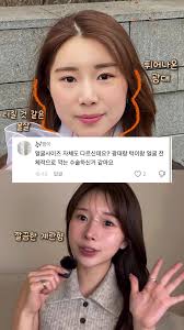 땅콩현 얼굴 특징