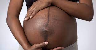 And i'm back to dying it now, tbh it never crossed my mind not too during my cycle, and after i had et it was actually on the advice sheet that the clinic gave me that it was ok to visit the hairdresser x 24 Weeks Pregnant Symptoms Hormones Baby Development