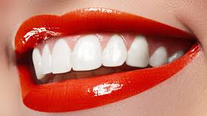 Elementos imprescindibles para conseguir una sonrisa bonita