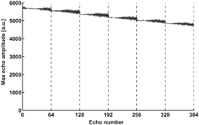 Verdaling og fotballspiller, 23 år. Hyperpolarized 13c Mr Angiography Using Truefisp Svensson 2003 Magnetic Resonance In Medicine Wiley Online Library