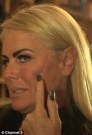 Former glamour model looks like she's been knifed after botched facelift