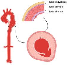 Image result for Aortic Dissection