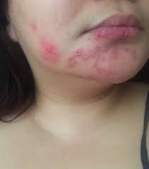 Bio Oil Before After 31 Amazing Skin Care Products With Over 1 000 Reviews Skin Care Best Skincare Products Mask For Oily Skin