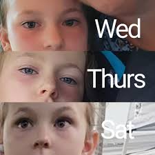 What to do for swollen eyes due to salt water reaction in Gulf Shores?