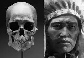 Malocclusion in ancient times exists