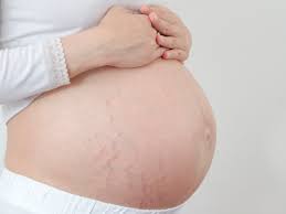 Grávida pode tomar dipirona? Veja se o remédio é permitido