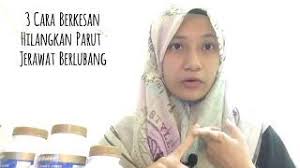 Nak tahu tak cara cepat dan berkesan untuk hilangkannya? Cara Hilangkan Parut Jerawat Berlubang Dengan Cepat Dan Selamat Youtube
