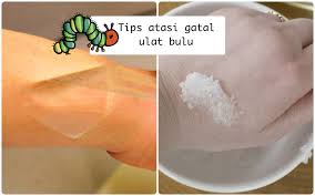 Gejala buli boleh didefinisikan sebagai masalah yang meliputi kegiatan seperti memeras ugut, menghina, mengejek, menumbuk, memaki dan sebagainya yang dilakukan oleh seseorang terhadap pemangsanya. Bukan Digaruk Ini 6 Cara Atasi Gatal Gara Gara Ketempelan Ulat Bulu Sebelum Menjalar Lo