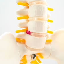 Image result for vyhřezlá ploténka