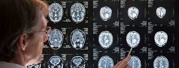 Learn important information about brain tumors including the average age for brain tumor diagnosis & how many tumors are diagnosed per year in america. Meningioma Recurrence Johns Hopkins Medicine