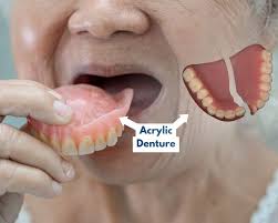 Image result for dentures