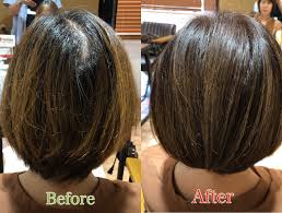 つむじ 割れ 後頭部