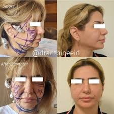 Dr. Antoine Eid MD, PhD