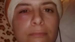 Brecon woman 'dependent'