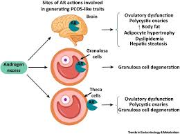 Pcos treatment depends on the woman's stage of life, which can include medication, birth control pills, and fertility treatments when pregnancy is desired. New Perspectives On The Pathogenesis Of Pcos Neuroendocrine Origins Sciencedirect
