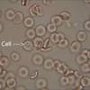 A scanning electron microscope picture of a nerve ending. 3