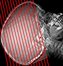 Image result for CT Head