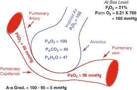 Image result for A-a Gradient