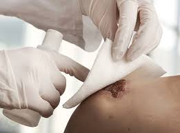 The term stable eschar is used to describe leathery, dry hard eschar tissue, such as the eschar that commonly forms on the heels or other bony prominences of the lower leg of patients with ischemic limbs. The Colour Of Wounds And Its Implication For Healing Healthtimes