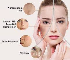 Kita semua idamkan kulit yang putih gebu dan terdapat banyak cara untuk dapatkannya, samada secara semulajadi atau moden dengan penggunaan ubat. Produk Untuk Melicinkan Kulit Muka Kepuasan Pelanggan Buktikan Ia Berkesan
