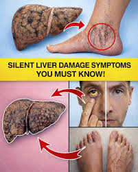 liver trouble warning signs and remedies