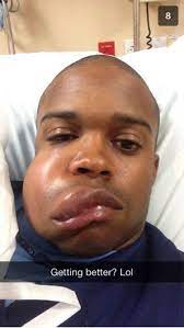 Sometimes a pitch will get in a little too close and hit a batter in the face or on the helmet. Baseball Player Hit In Face With Fastball Pic