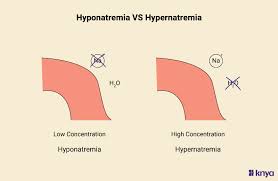 Image result for Hypernatremia