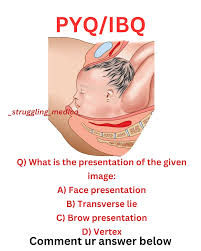 Image result for Brow Presentation