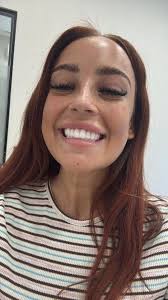 I got £4K Turkey teeth even though they won't last past my 35th birthday