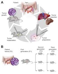 Wonder woman 1984 (2020) cast and crew credits, including actors, actresses, directors, writers and more. Biliary Tract Cancer Patient Derived Xenografts Surgeon Impact On Individualized Medicine Jhep Reports