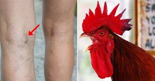 Beli telur ayam jago online berkualitas dengan harga murah terbaru 2021 di tokopedia! Kumpulkan Telur Nenek Ini Malah Tewas Dipatuk Ayam Jago