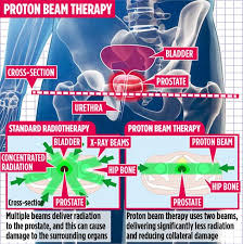 This test measures the level of psa in your blood. Prostate Cancer Breakthrough To Save Your Sex Life Daily Mail Online