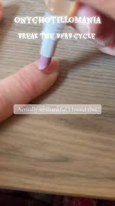 Image result for Onychotillomania feet