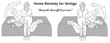 Brandt Daroff Exercise For Vertigo In 2021 Vertigo Treatment Vertigo How To Cure Vertigo