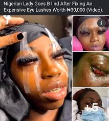 The Dangers of Beauty Procedures Gone Wrong