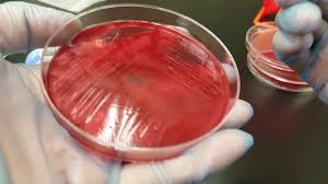 Maybe you would like to learn more about one of these? Microbiology Clostridium Perfringens Biochemical Testing And Colonial Growth Youtube