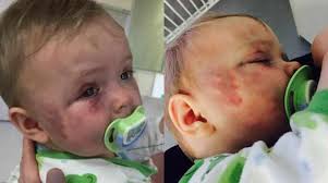 Pai desabafa após mãe espancar a bebê deles e não ser presa