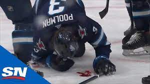 Aug 05, 2020 · poolman put his face in the way to stop the shot. Tucker Poolman Blocks A Wrist Shot With His Face Vs Flames Youtube