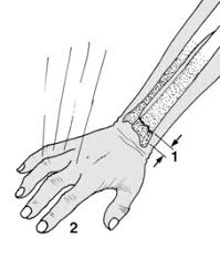 9 Main Et Poignet Medicine Key