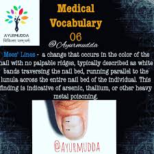 Image result for Mees Line