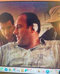 Tony Sirico's hilarious mosquito bite story