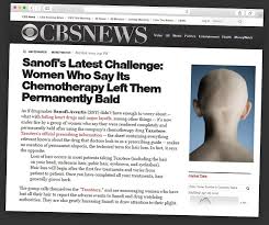 However, while this can't be prevented entirely, it can be mitigated somewhat with the advice. Pin On Alopecia